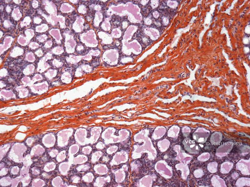 哺乳期乳腺组织光学显微照片图片素材
