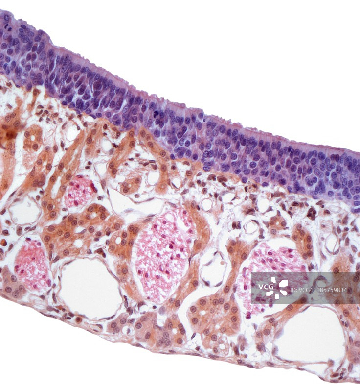 鼻粘膜显微照片图片素材