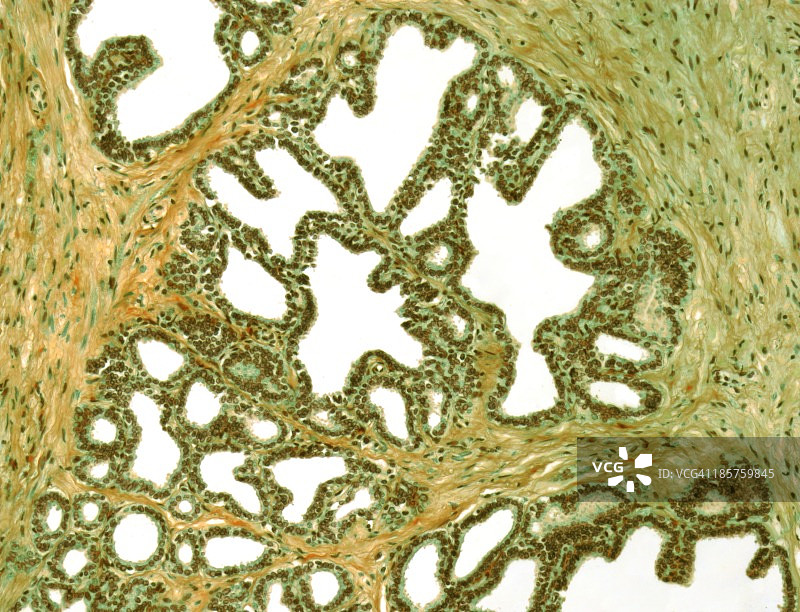 精囊腺显微照片图片素材