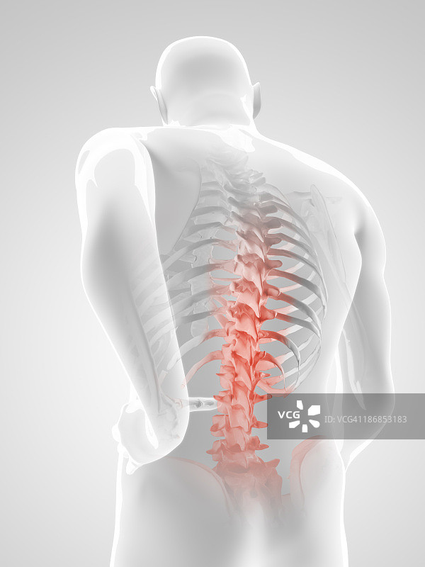 背痛插画图片素材