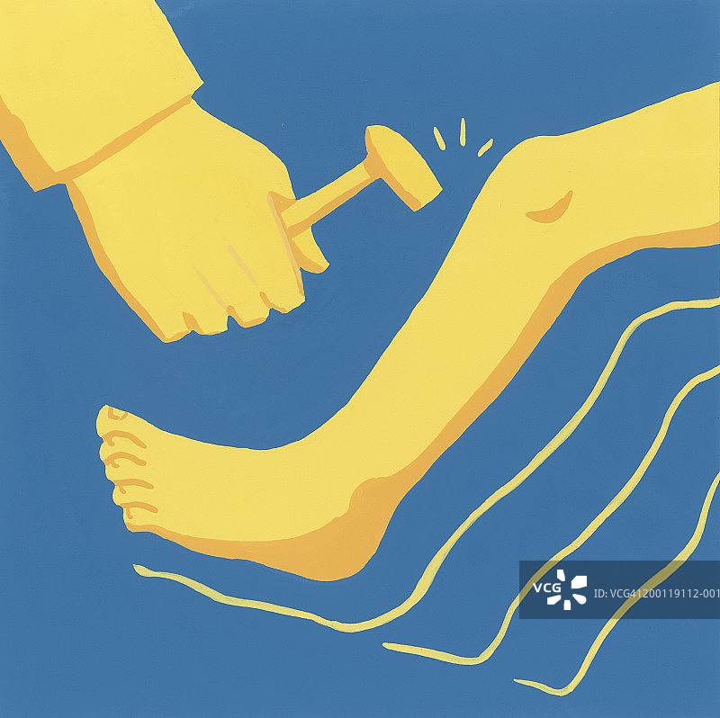 医生用反射锤检查病人膝盖图片素材