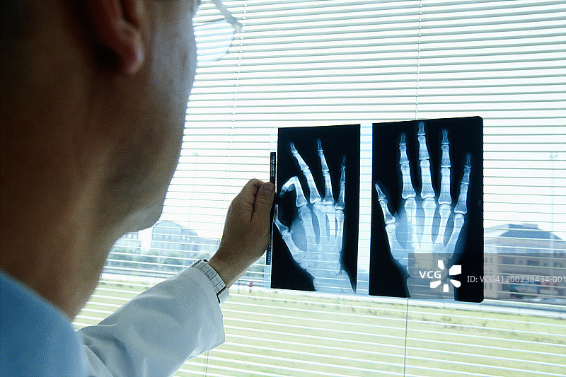 正在查看手部X光片的放射科医生图片素材