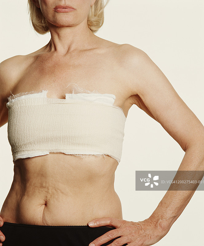 胸部缠着绷带，双手叉腰的中年妇女图片素材