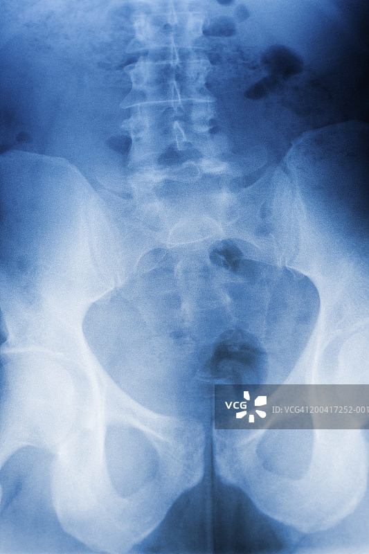 健康成年男性骨盆和下背部X光片图片素材