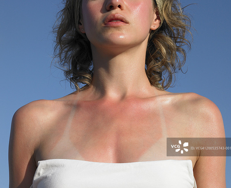 年轻女人有晒伤痕迹，中段图片素材