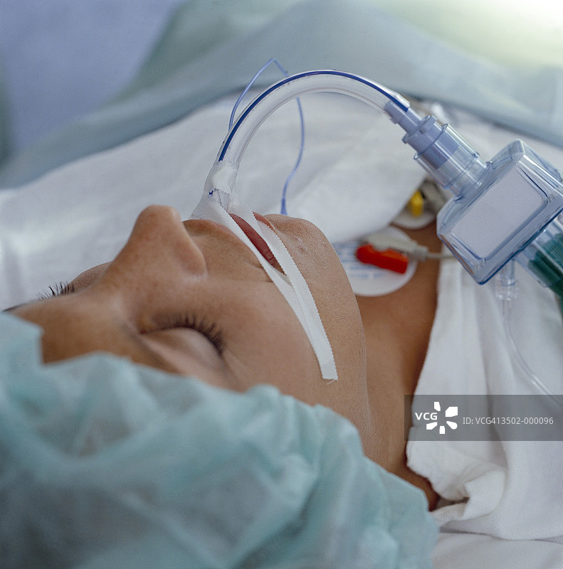 病人经导管呼吸图片素材
