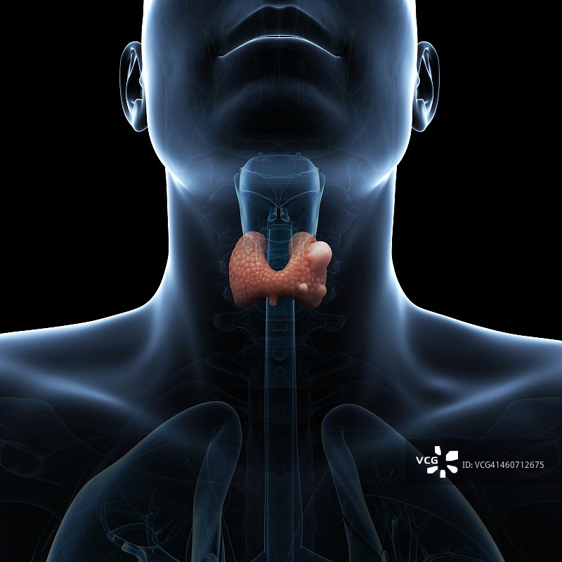 甲状腺癌艺术插图图片素材