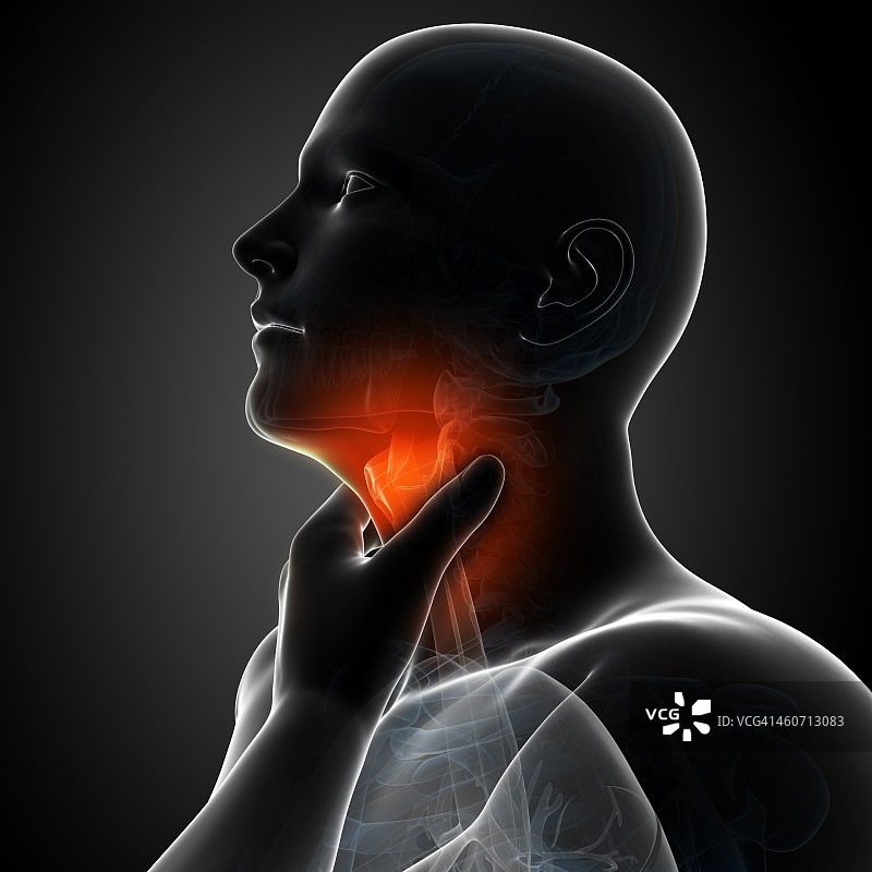 嗓子疼，艺术作品图片素材