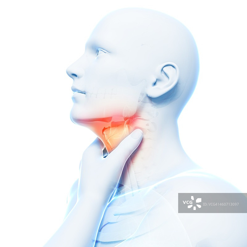 嗓子疼，艺术作品图片素材