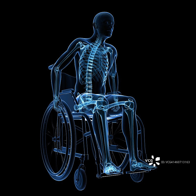 轮椅上的男人，艺术作品图片素材