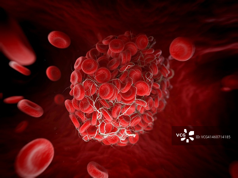 血栓艺术作品图片素材