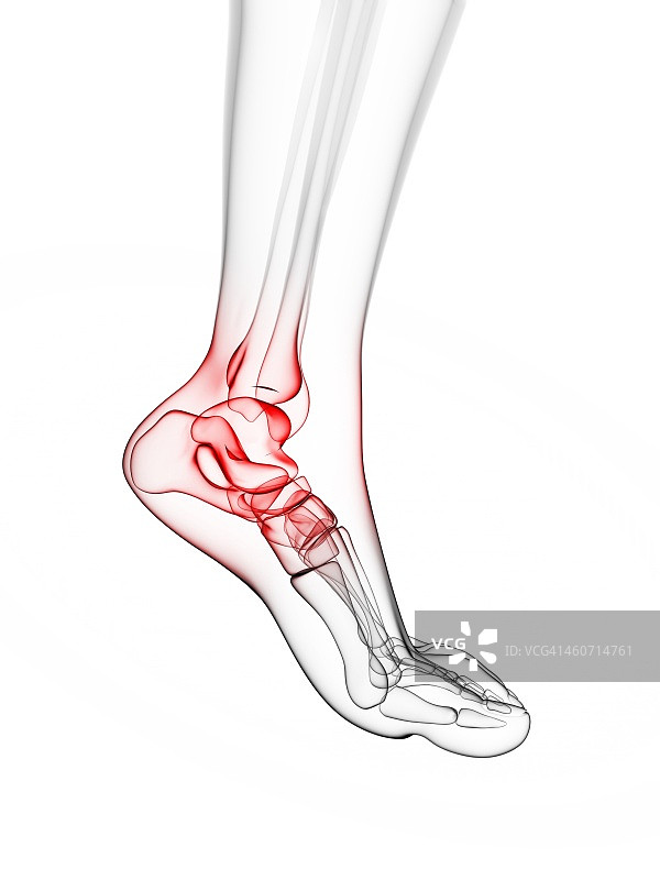 脚踝疼痛示意图图片素材