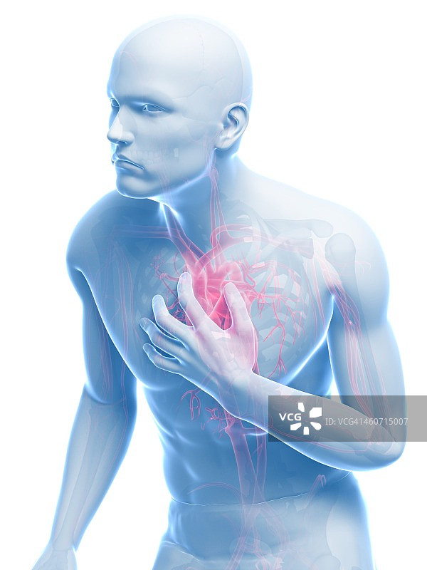 心脏病发作艺术图图片素材