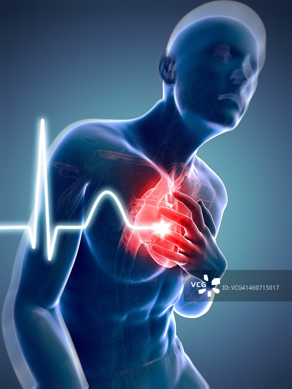 心脏病发作艺术图图片素材