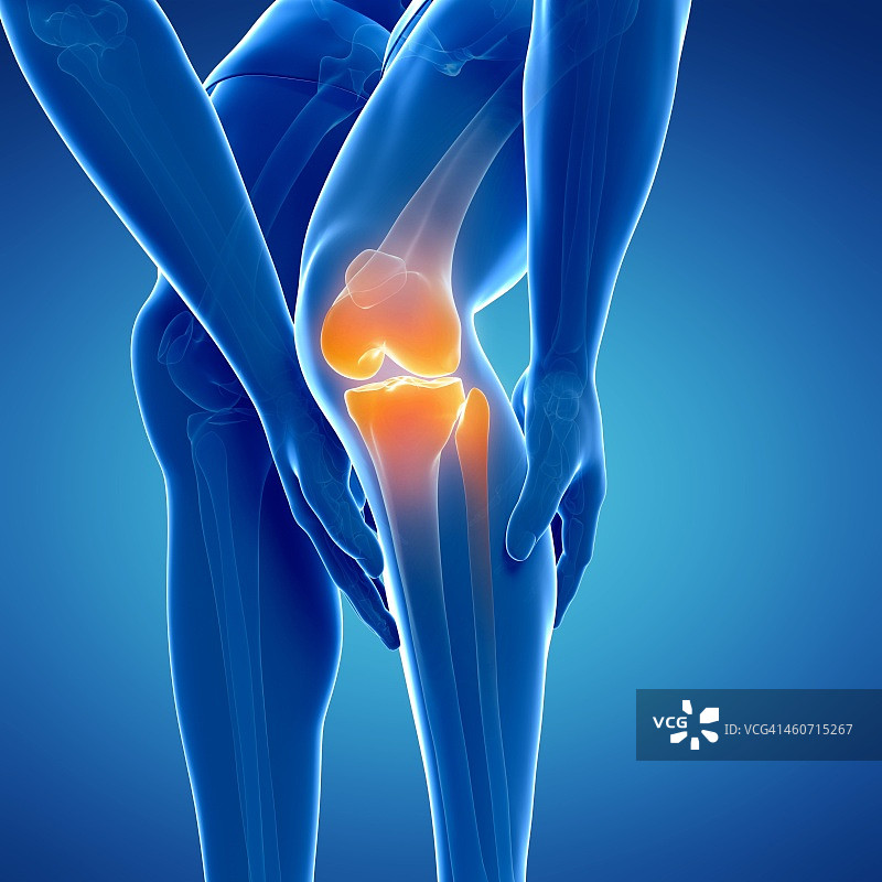 疼痛的膝盖，图示图片素材