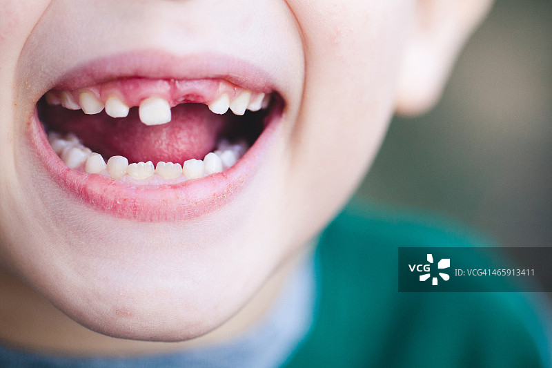 无齿的奇迹图片素材