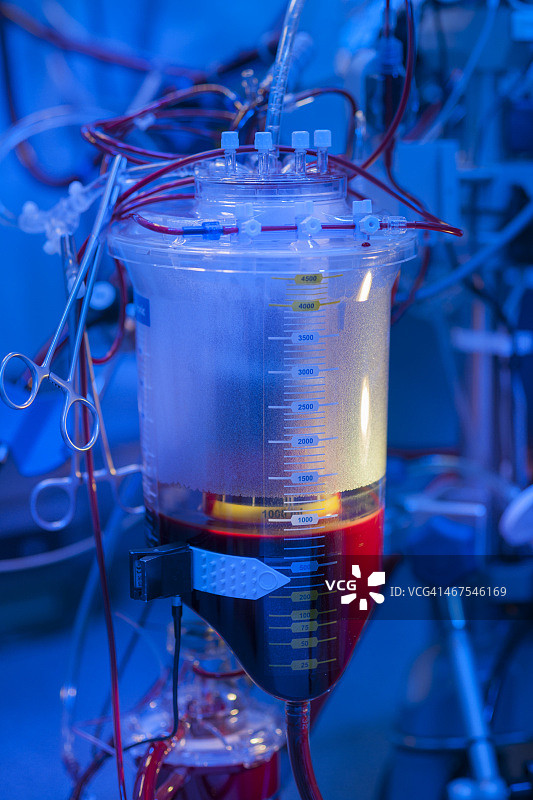 体外血液循环机图片素材