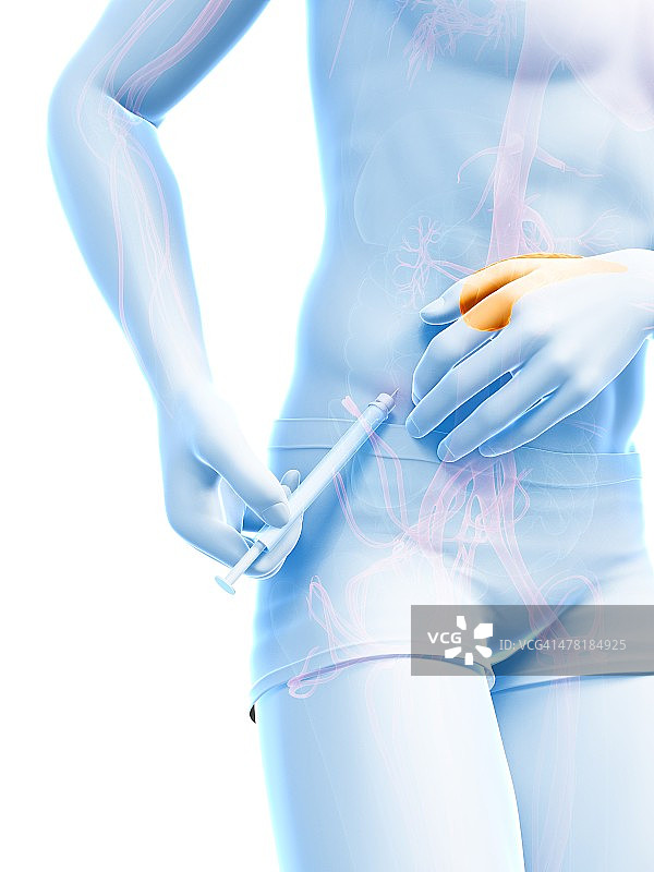 胰岛素注射示意图图片素材