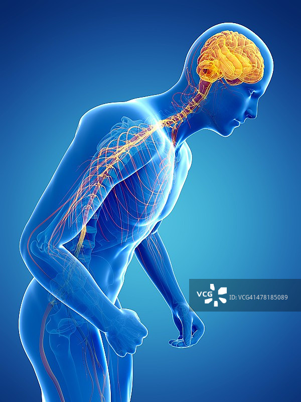 帕金森病概念艺术图片素材