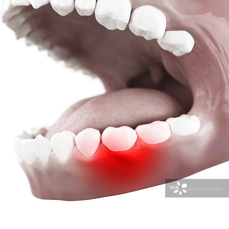 牙痛概念艺术作品图片素材