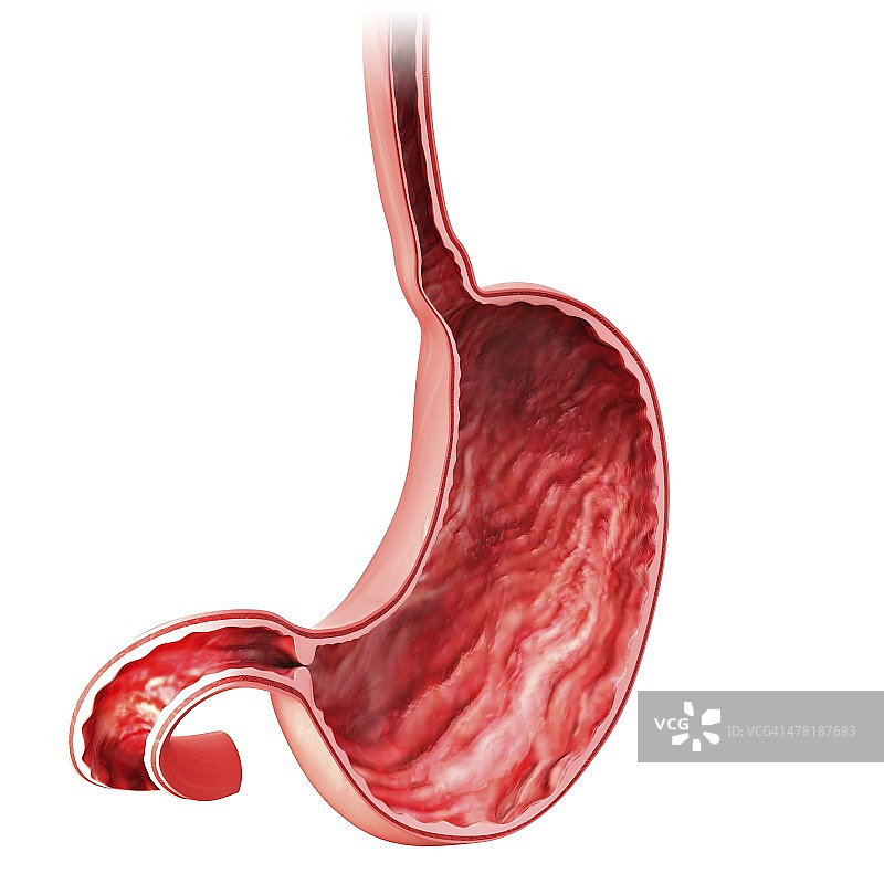 人体胃部艺术作品图片素材