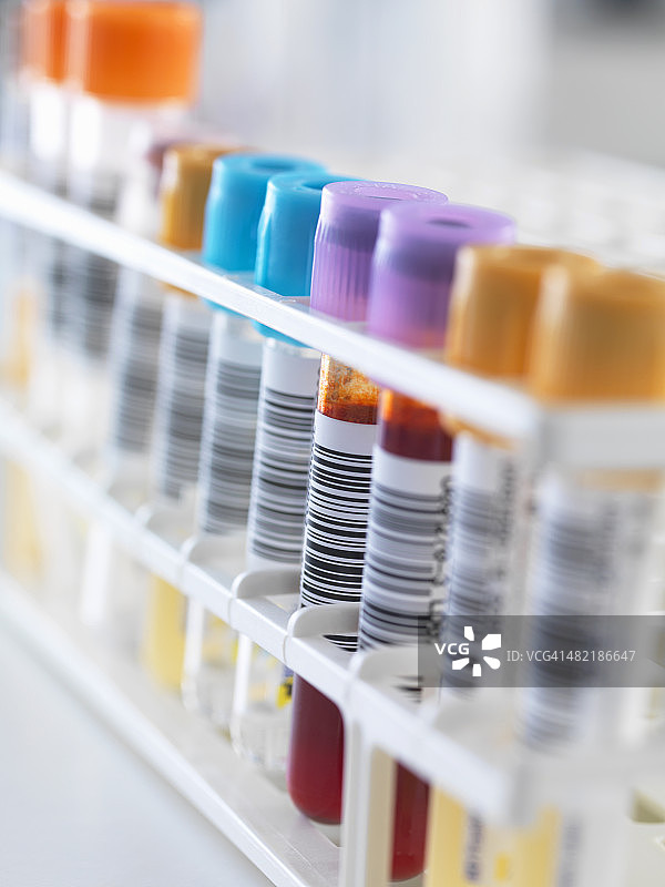 用于分析测试的人体样本：血液、尿液等图片素材