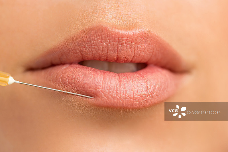 用于丰唇的胶原蛋白注射图片素材