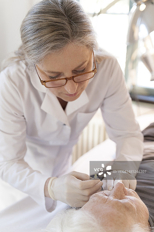 替代疗法医师为年长女性进行针灸图片素材