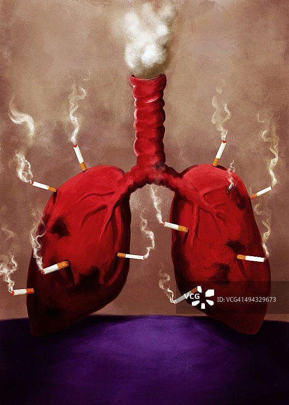 香烟附着在肺部：肺癌插画图片素材