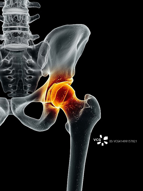 人类髋关节艺术图图片素材