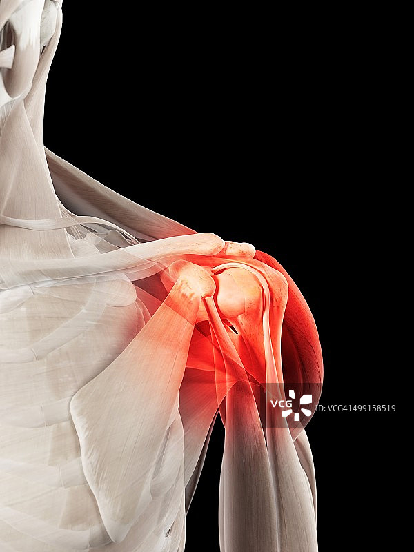 人类肩膀艺术作品图片素材