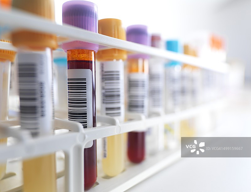 血样架上的血液样本图片素材