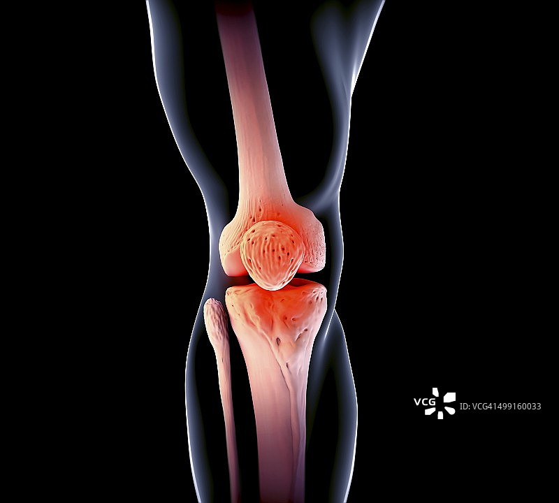 膝关节，艺术作品图片素材