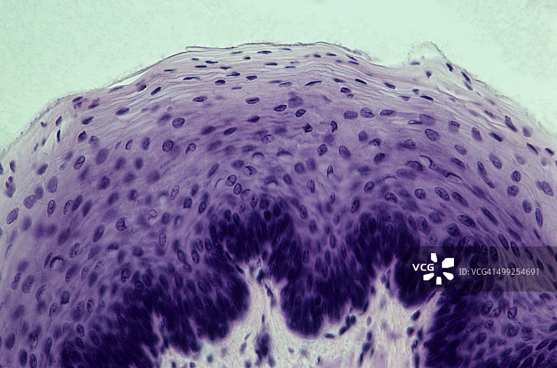 非角化复层扁平上皮图片素材
