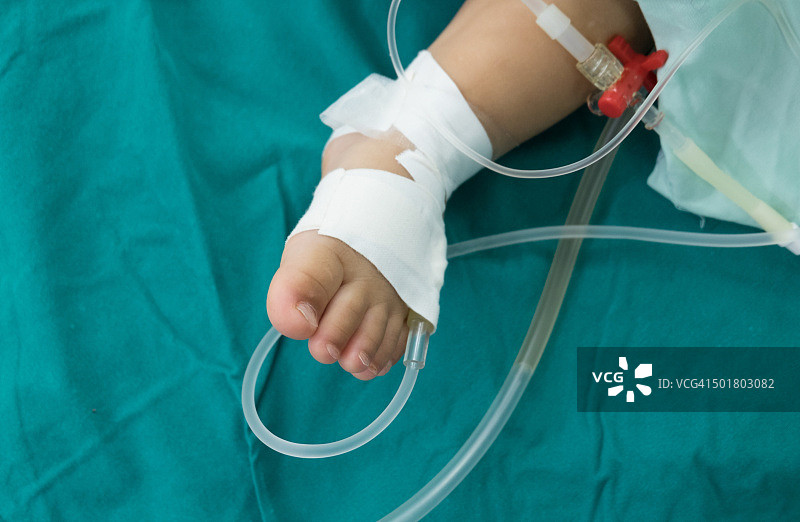 儿科手术图片素材