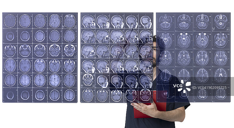 医生检查CAT扫描图像图片素材