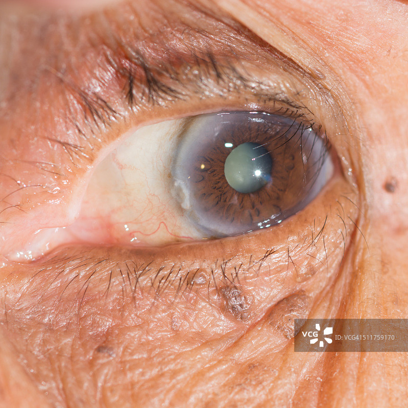 视力测试图片素材