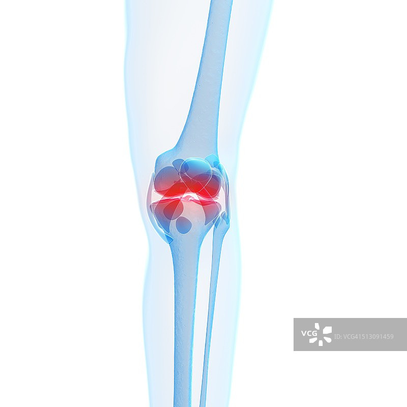 人类膝盖疼痛，艺术作品图片素材