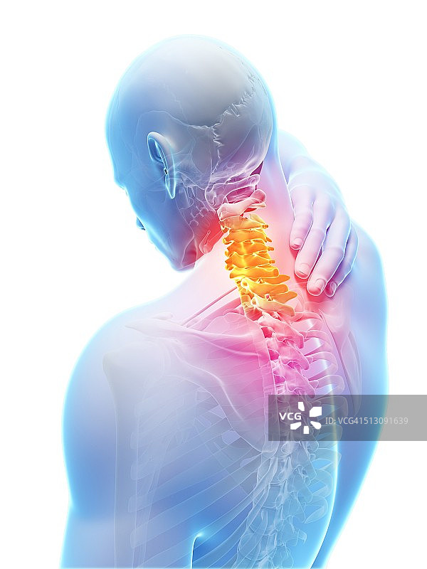 人类颈部疼痛示意图图片素材