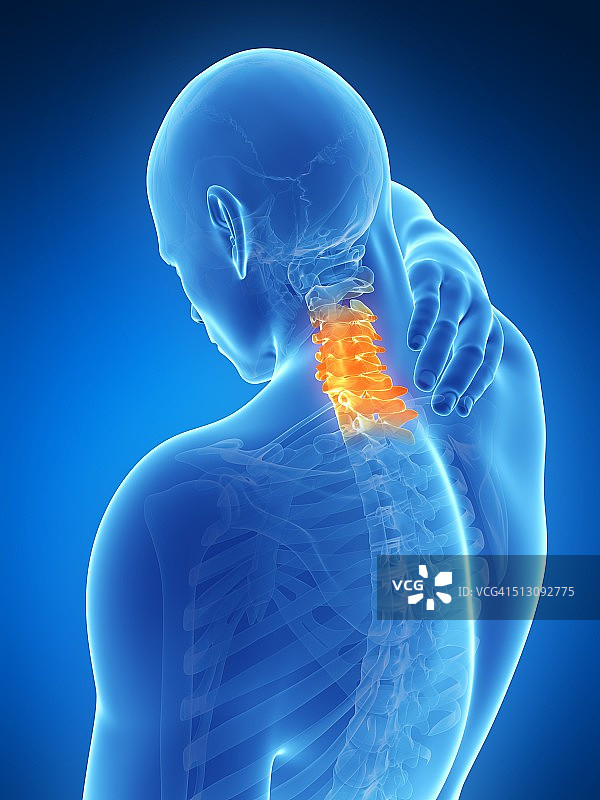 人类颈部疼痛示意图图片素材