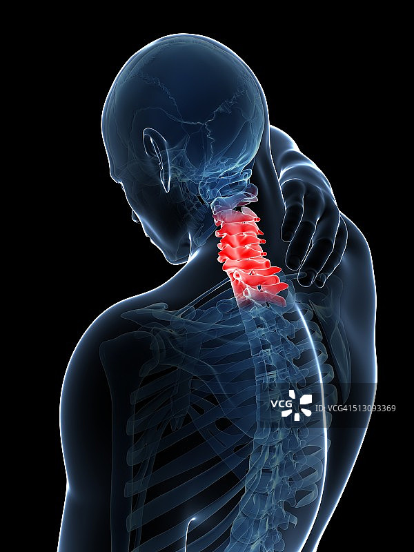 人类颈部疼痛示意图图片素材