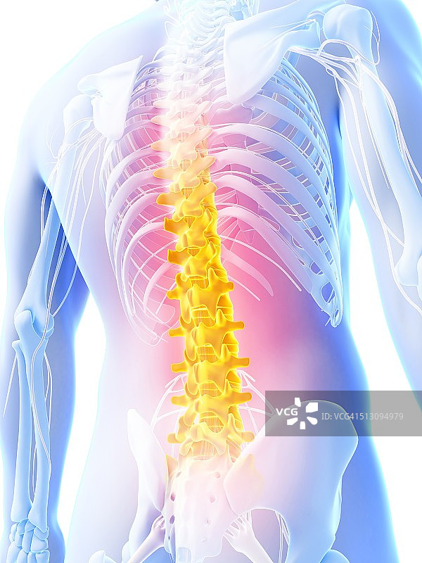 人类背痛医学插画图片素材