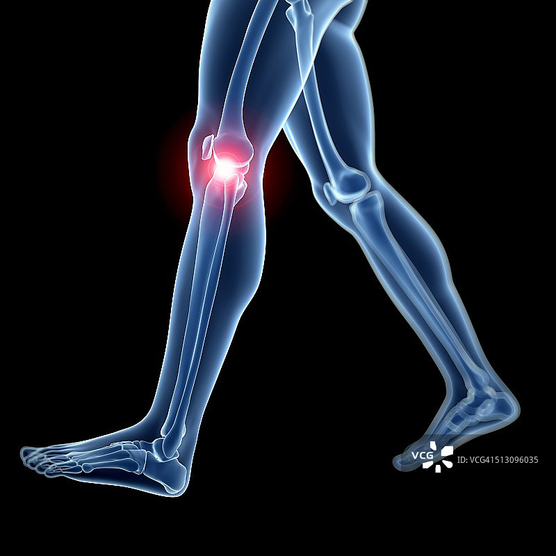 人类膝盖疼痛，艺术作品图片素材