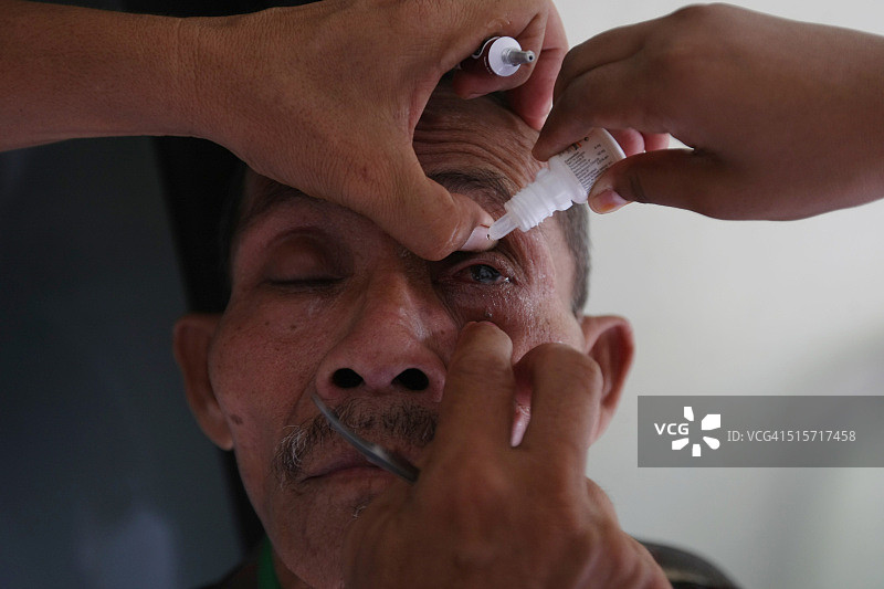 白内障手术图片素材