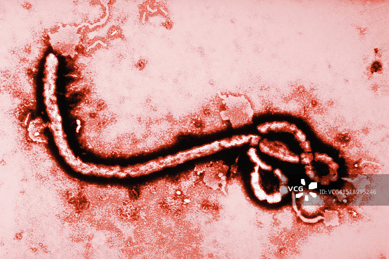 埃博拉病毒108000倍放大图图片素材