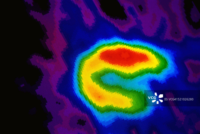 心脏PET扫描图片素材
