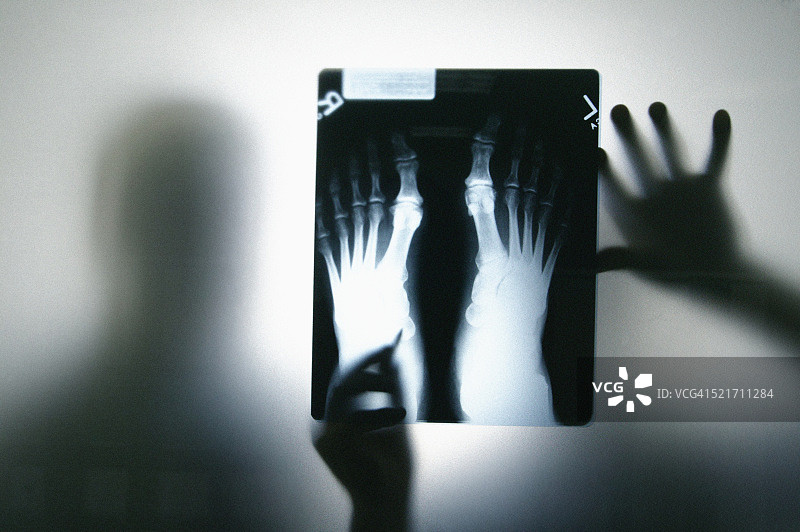 医生分析X光片图片素材