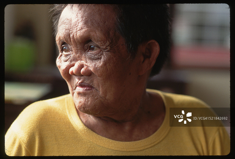 菲律宾疗养院的麻风病患者图片素材