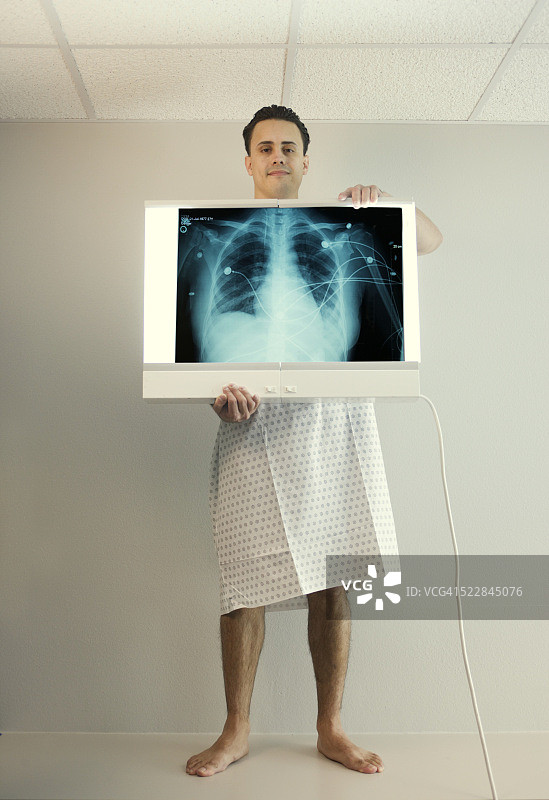 病人手持肺部X光片图片素材