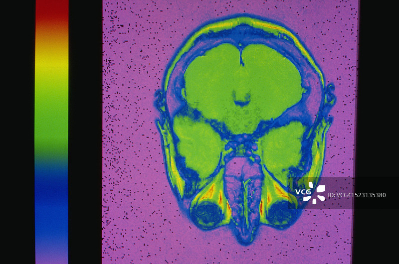 大脑扫描图片素材